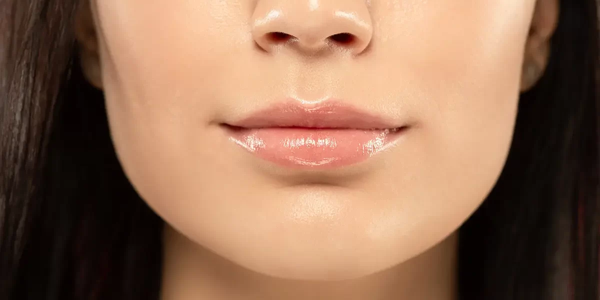 lip lift