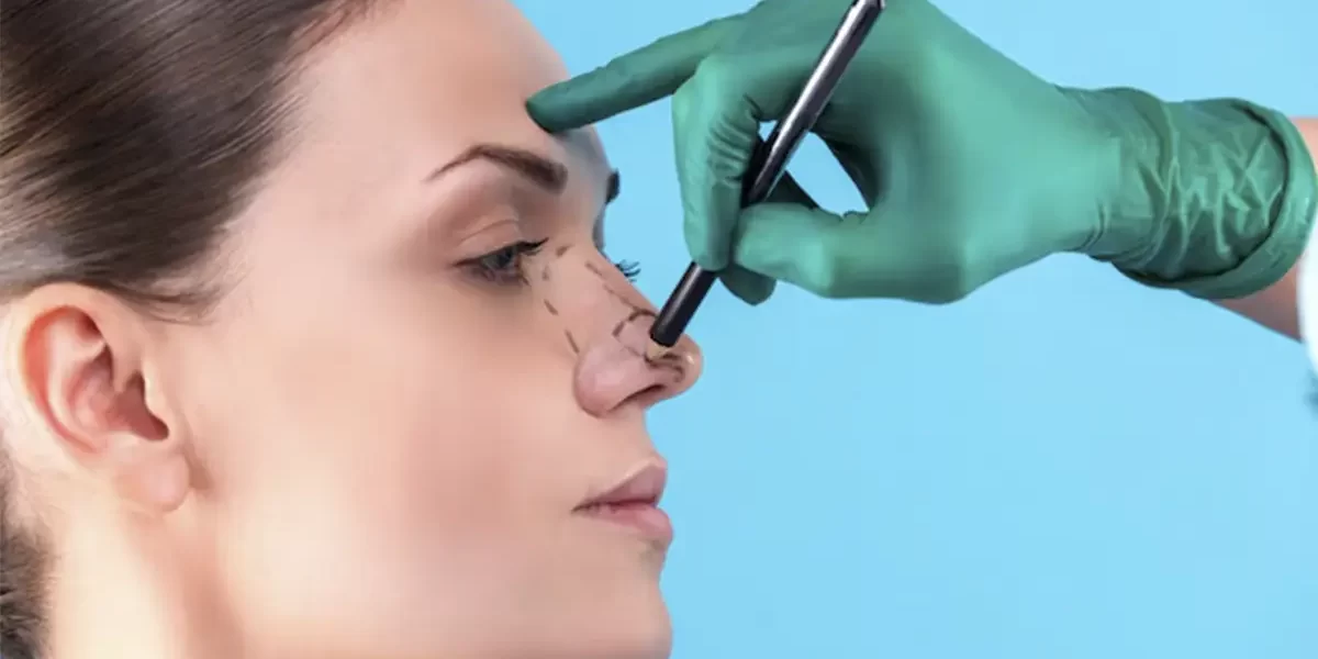 Com quanto anos pode fazer rinoplastia